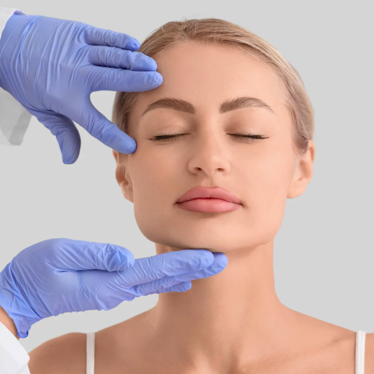 upper-blepharoplasty-4
